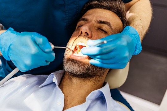 usunięcie zęba u dentysty